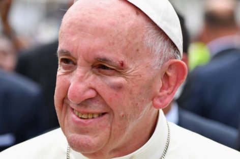 ¡Dolió! El Papa Francisco se golpeó contra el Papamóvil (Videos)