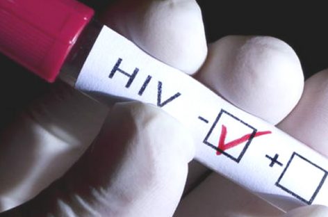 Comunidades de las comarcas son más vulnerables de infectarse con VIH