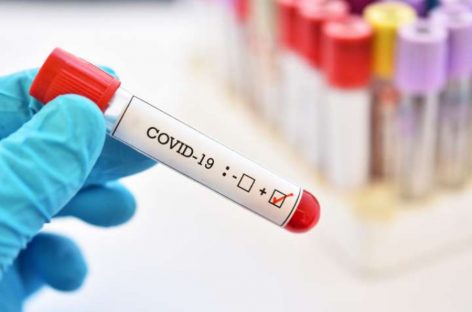 Panamá acumula 21.962 contagios a 100 días de confirmado el primer caso de COVID-19