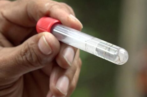 Minsa reporta 2 mil 859 casos de dengue